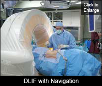 DLIF with navigation