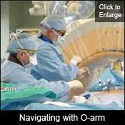 Navigating with O-arm
